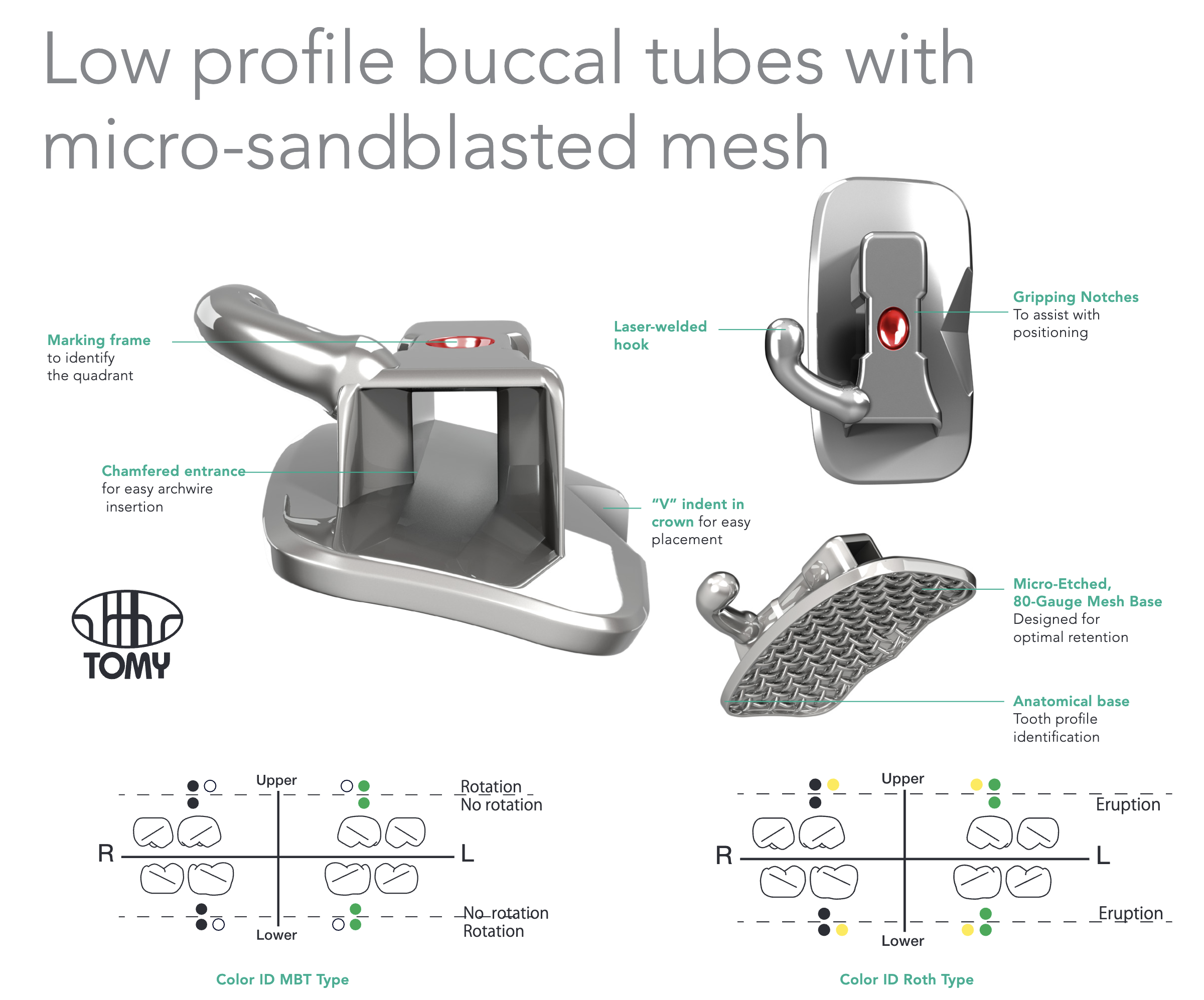 Buccal Tube Systemer
